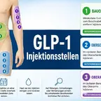 GLP-1 Injektionsstellen Bauch Oberschenkel Oberarm Rotationsschema Vergleich